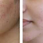 de ovaÉ signature skincare collection pack of 3