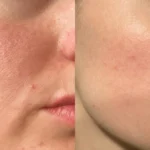 visible skin texture pores shown 600nw 2583903851
